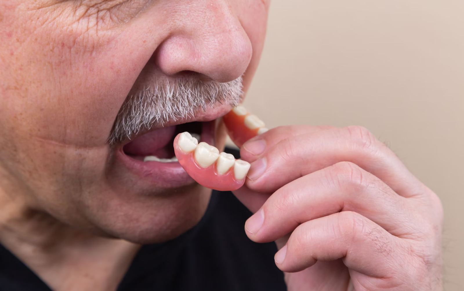 5 Reasons Why You Should Opt For Custom Made Dentures